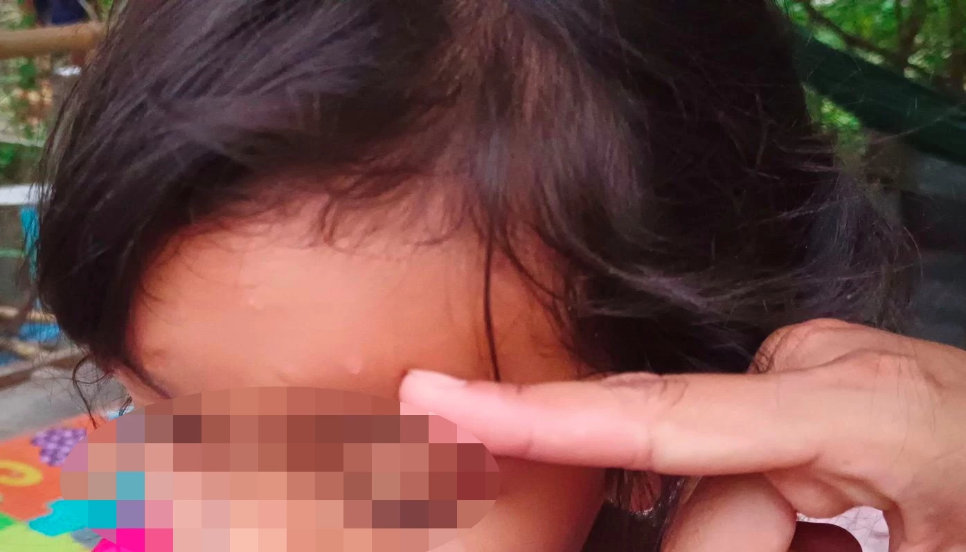 บีบหัวใจ! แม่ร้องลูก ป.2 โดนครูโยนหนังสือใส่หัวเลือดซึม แค่ทำการบ้านผิด