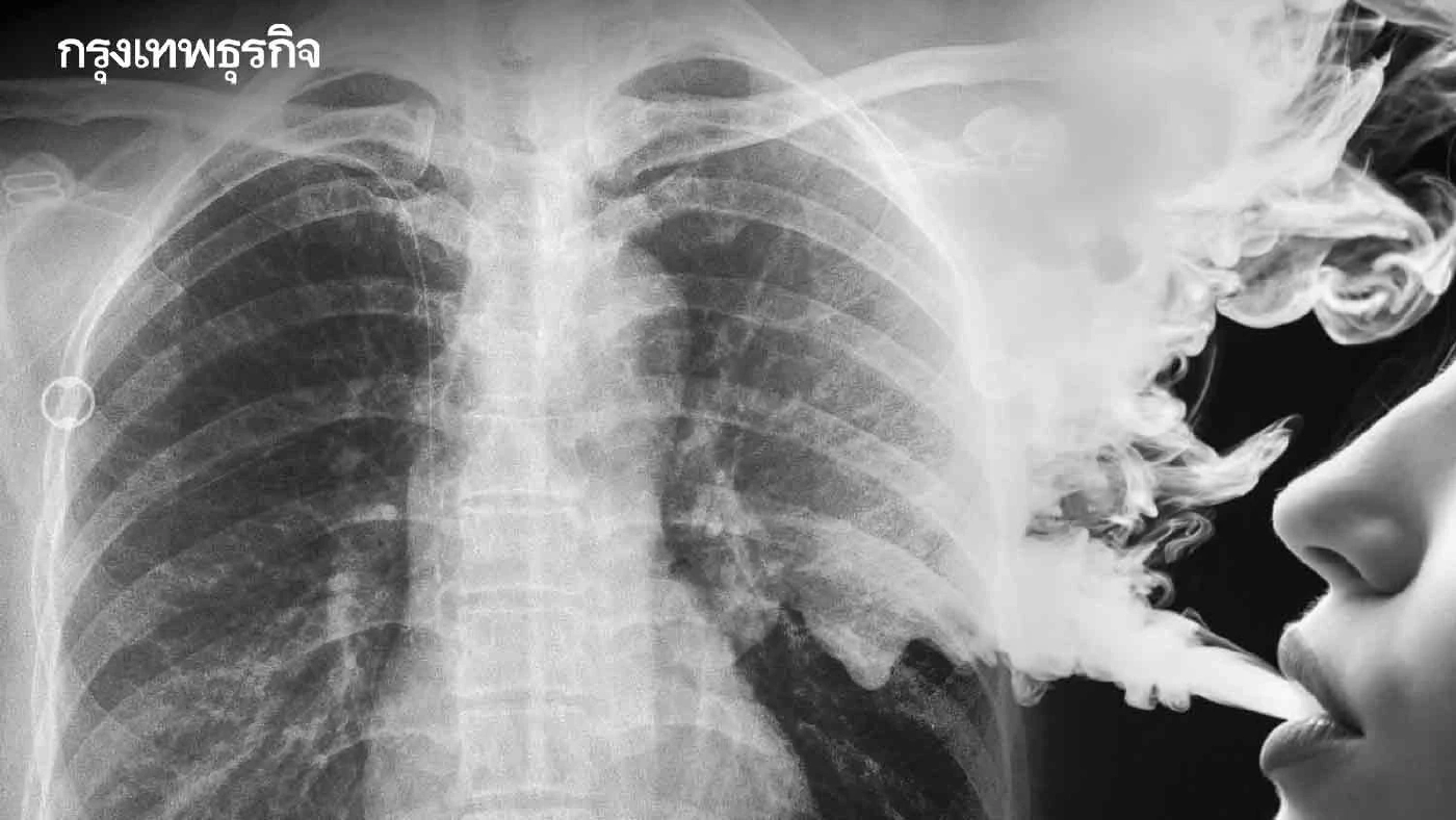 เผยอันตรายจากบุหรี่ไฟฟ้า สารพิษเพียบ สุดทึ่งเจอสารไซยาไนด์ในปัสสาวะคนสูบ