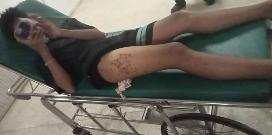 ด.ช.ฟีม ผู้บาดเจ็บ