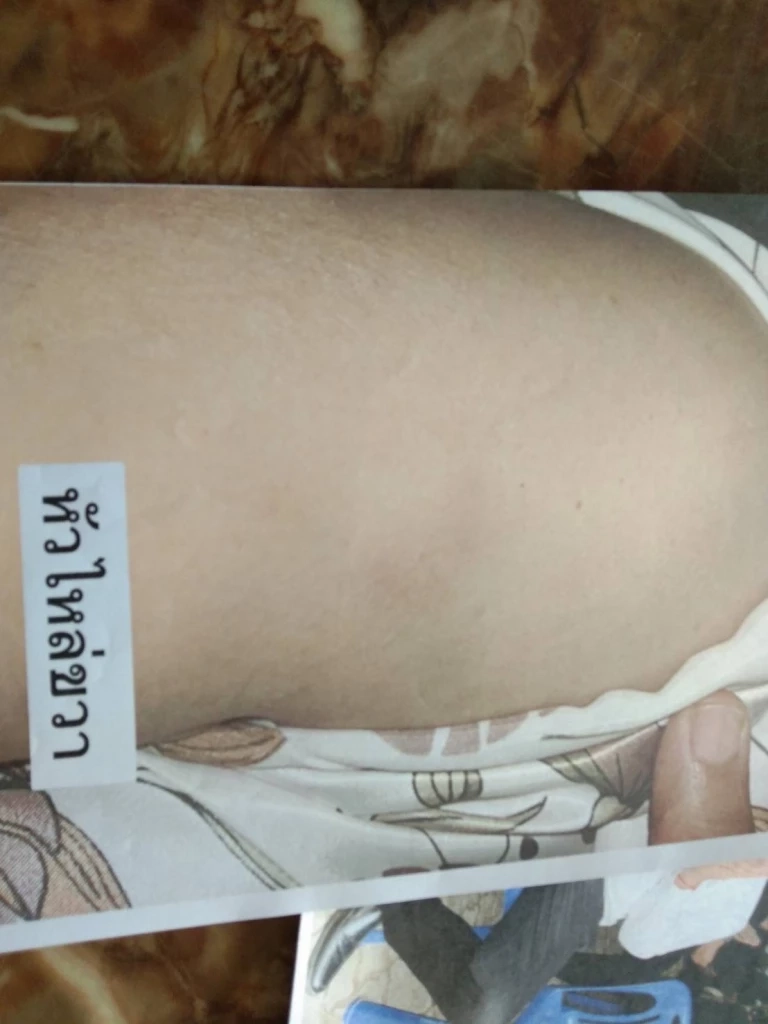 "เลือกตั้งจบแต่คนไม่จบ" ว่าที่ส.ส.อำนาจเจริญ พรรคภท. จะตบกับผู้สมัครพปชร.