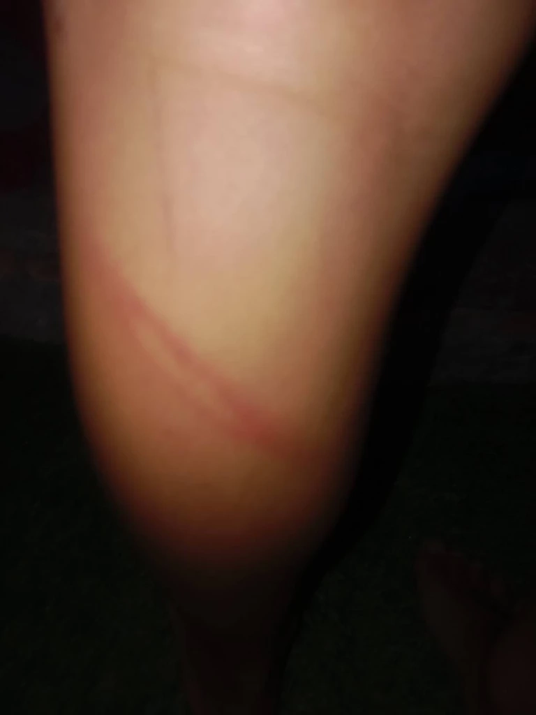 ครู - นร. รายวัน! ผู้ปกครองโพสต์ ครูหวดเด็กน่องลาย เหตุลุยฝนตกรองเท้าเปียก