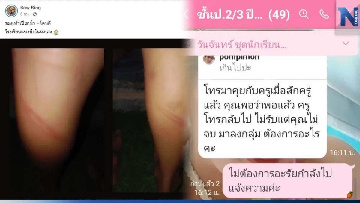 แจงแล้ว! ครูตีเด็กน่องลายเพราะรองเท้าเปียก ผอ.ยันทำเพื่อป้องกันเด็ก