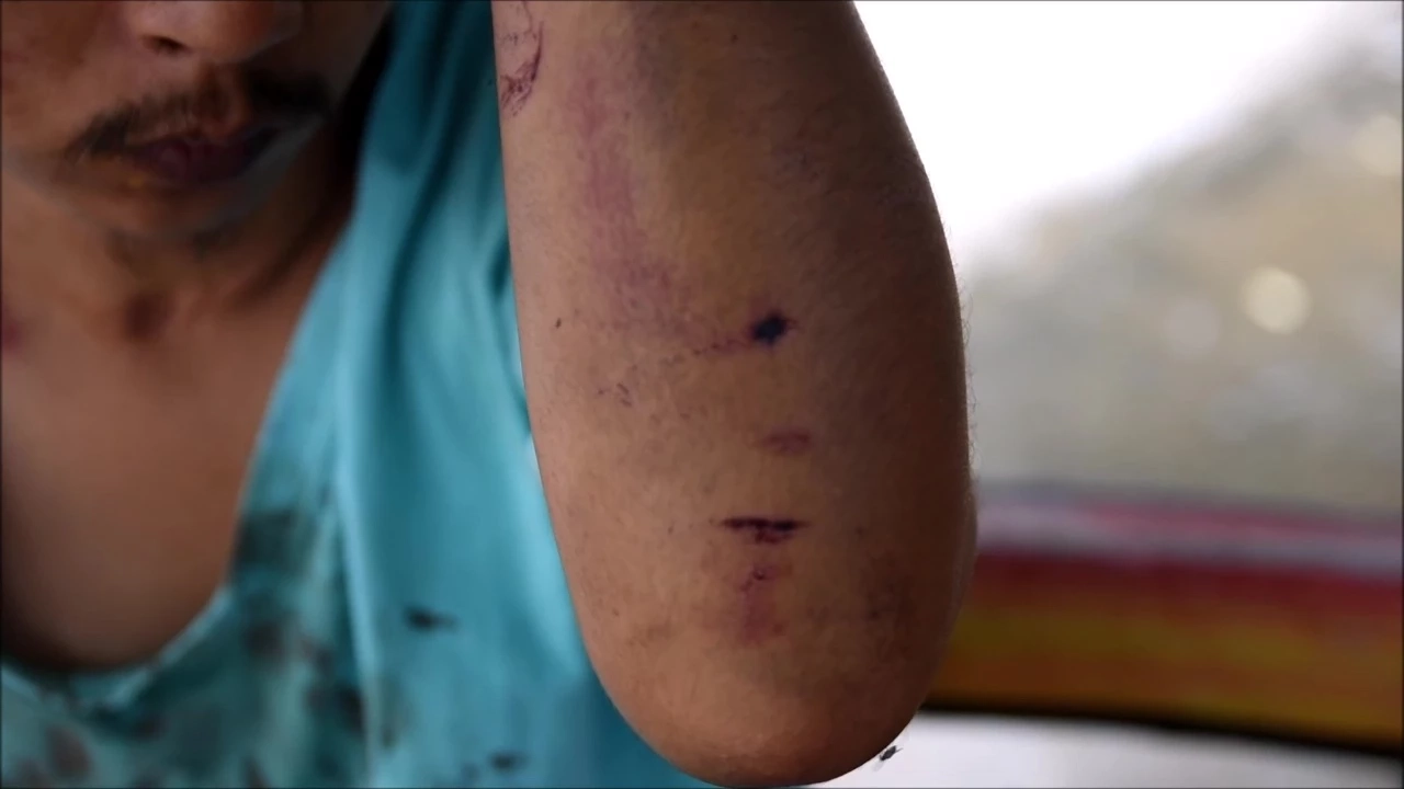 หนุ่มอุดรแจ้งความ ถูกพระทำรุมร้าย หัวแตกเย็บหลายเข็ม พระโต้หนังคนละม้วน