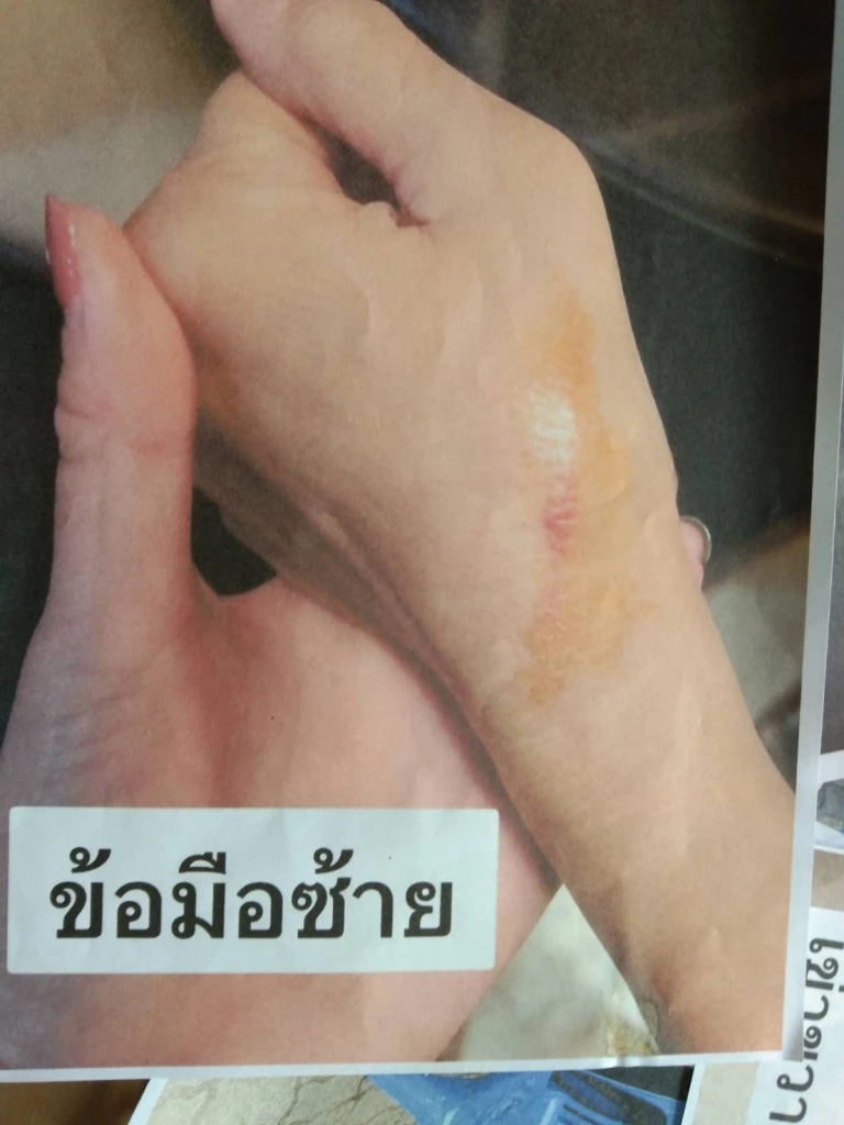 "เลือกตั้งจบแต่คนไม่จบ" ว่าที่ส.ส.อำนาจเจริญ พรรคภท. จะตบกับผู้สมัครพปชร.