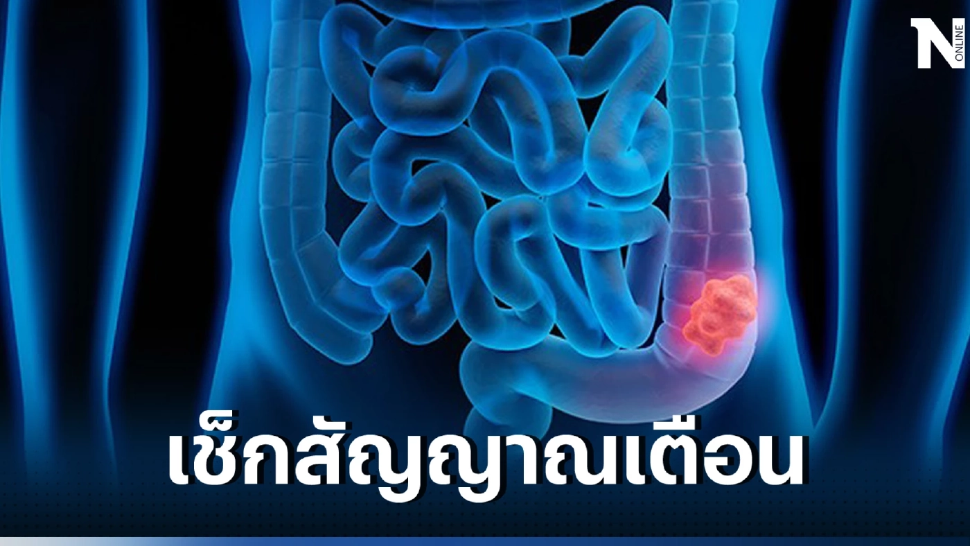 เช็กอาการ สัญญาณเตือน มะเร็งลำไส้ใหญ่ รีบพบแพทย์ด่วน ก่อนสายเกินไป