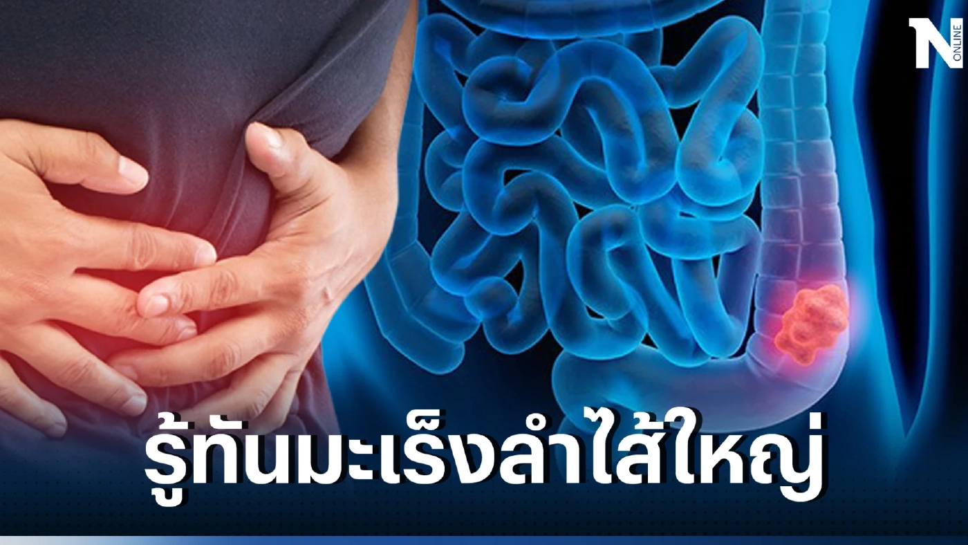 เช็กอาการ สัญญาณเตือน มะเร็งลำไส้ใหญ่ รีบพบแพทย์ด่วน ก่อนสายเกินไป