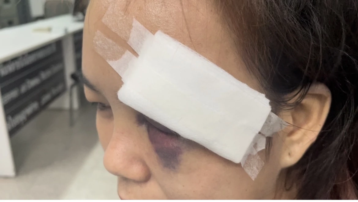 น้องฝ้าย สาวคาราโอเกะ ผู้เสียหาย