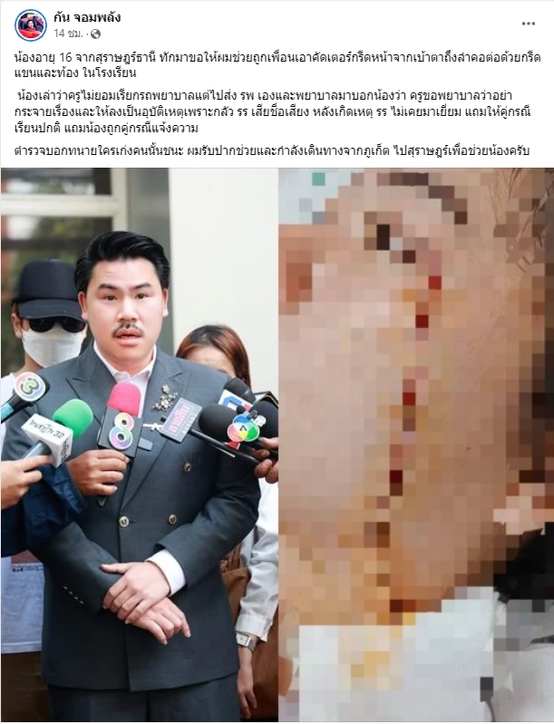 "กัน จอมพลัง" ลุยช่วยสาว 16 ปี ถูกเพื่อนโรงเรียนดังสุราษฎร์ กรีดหน้าเสียโฉม