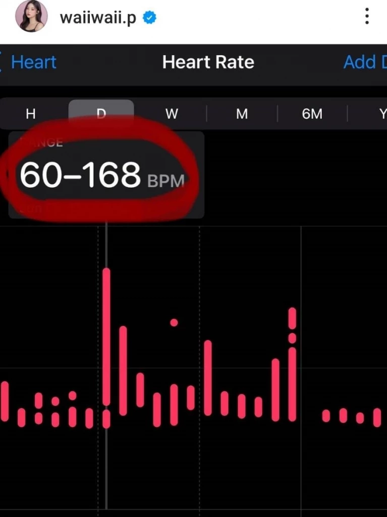 ส่งกำลังใจด่วน หวาย ปัญญ์ธิษา แอดมิท หลังพบภาวะ Heart Attack