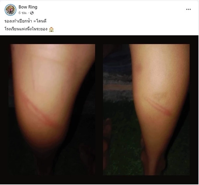 ครู - นร. รายวัน! ผู้ปกครองโพสต์ ครูหวดเด็กน่องลาย เหตุลุยฝนตกรองเท้าเปียก