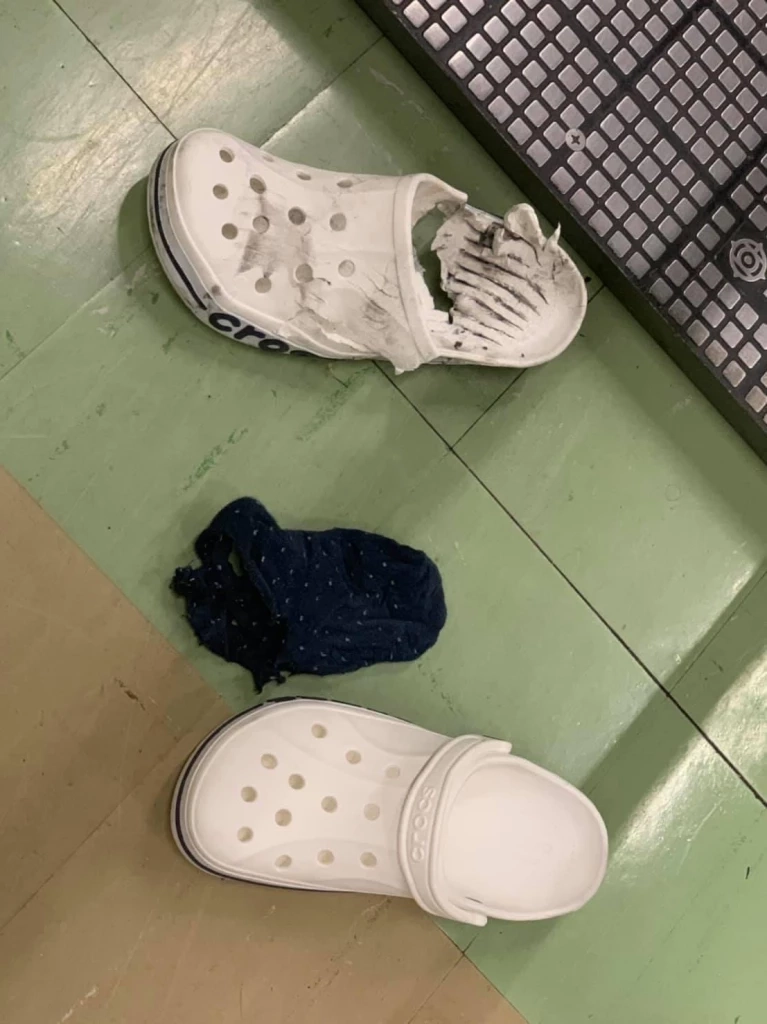 ไม่ใช่ครั้งแรก! ผู้โดยสารเล่าทางเลื่อนดอนเมือง ดูดรองเท้า ปี 62 สภาพขาดเละ