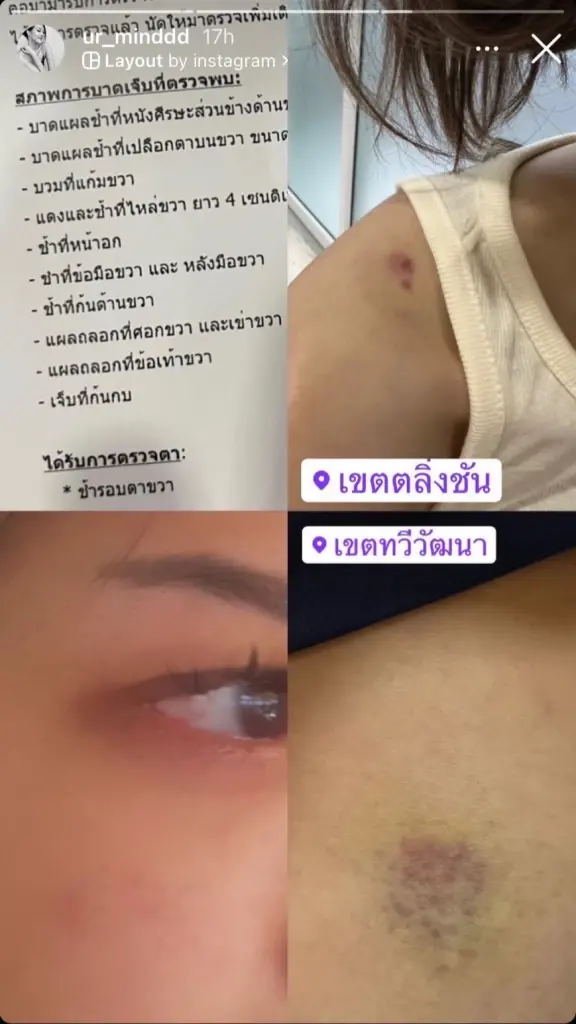 "ก้าวไกล" เร่งสอบส.ส.ทำร้ายสาวผู้ช่วยหาเสียง หลังวิจารณ์ยับทั่วโซเชียลฯ