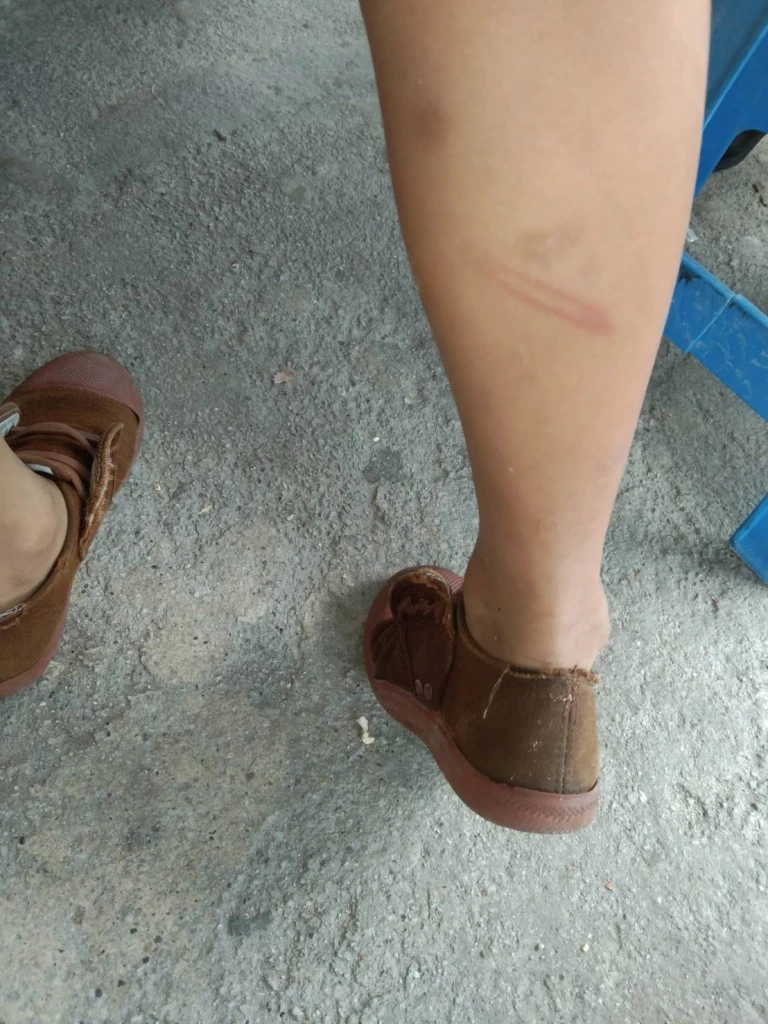 ครู - นร. รายวัน! ผู้ปกครองโพสต์ ครูหวดเด็กน่องลาย เหตุลุยฝนตกรองเท้าเปียก