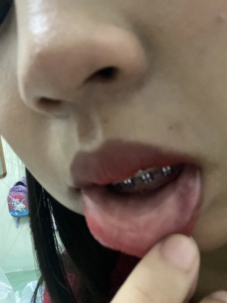 สาวเชียร์เบียร์แจ้งจับอดีตทหาร ตบหน้า-ถีบหงายหลัง กล่าวหาจับหนอนน้อย