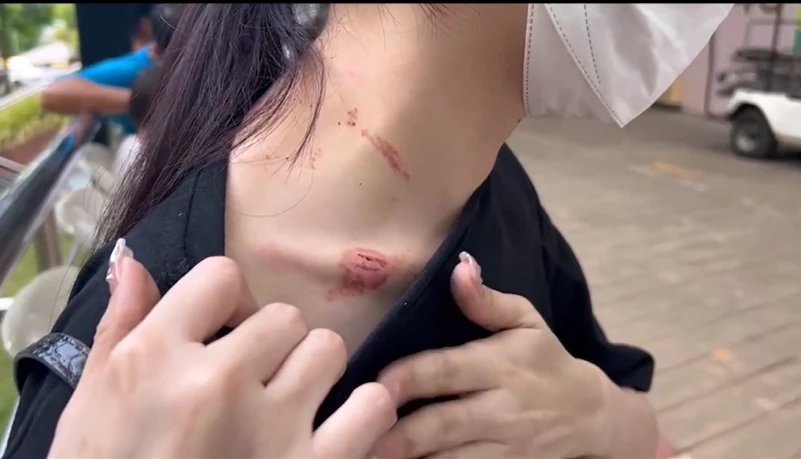 สภาพร่องรอยบาดแผล