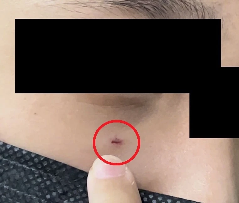 แม่เดือด! แจ้งจับครูคณิตศาสตร์ เขวี้ยงปากกาหวิดเข้าตาลูก