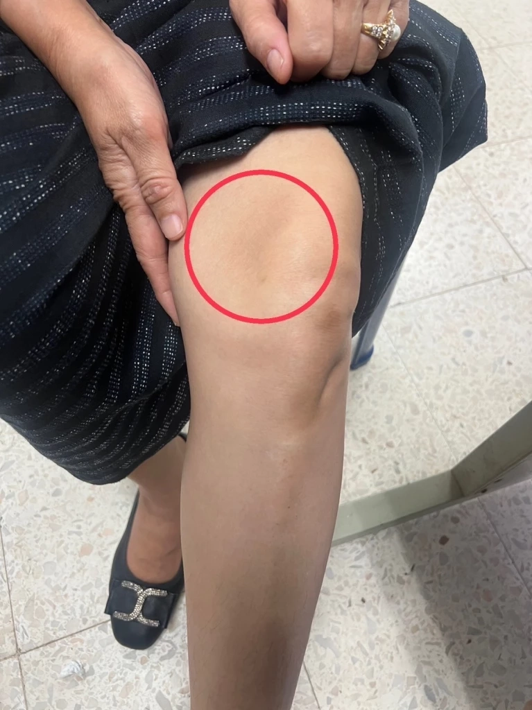 "เลือกตั้งจบแต่คนไม่จบ" ว่าที่ส.ส.อำนาจเจริญ พรรคภท. จะตบกับผู้สมัครพปชร.