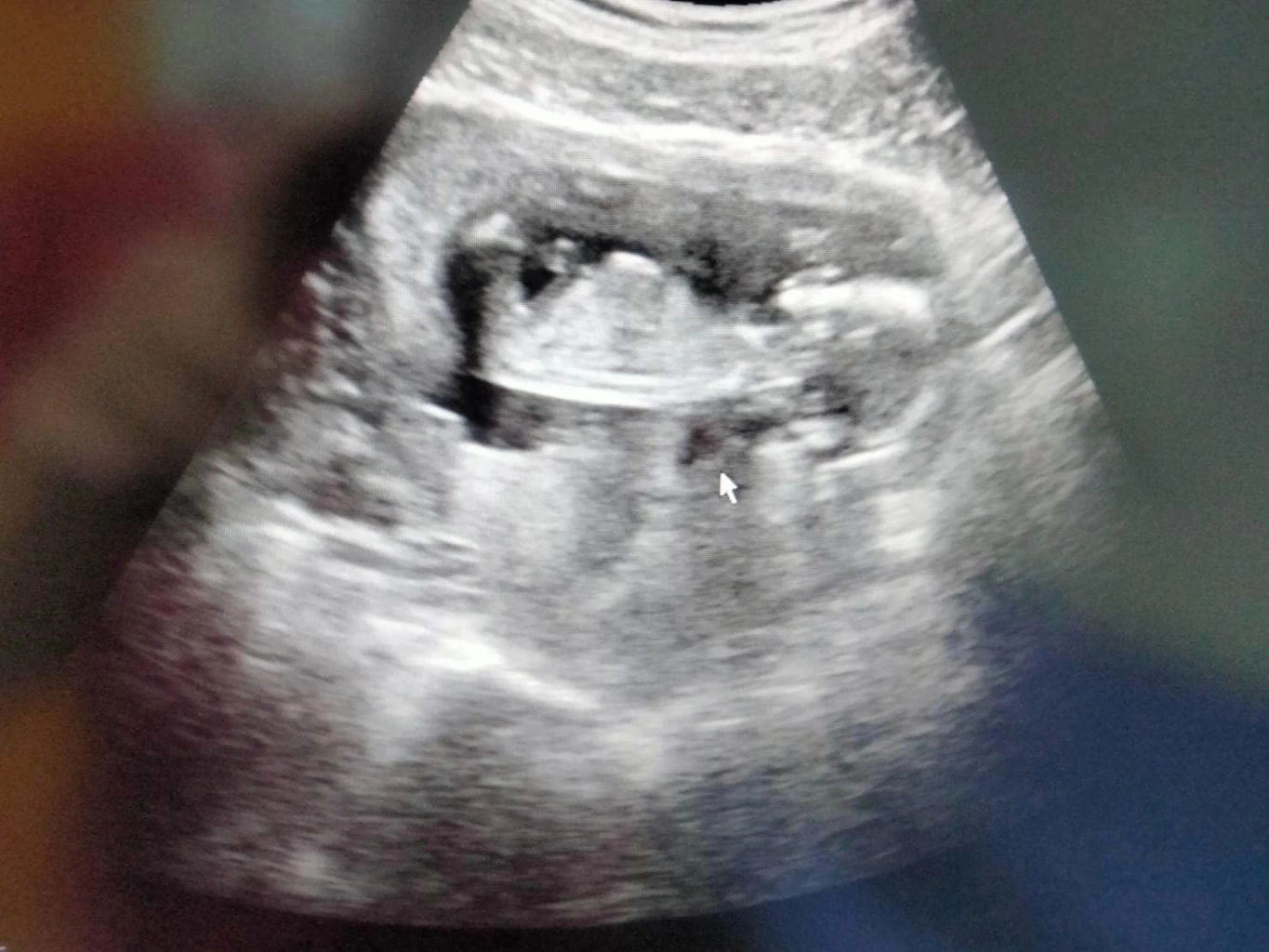 "โสรยา" เผยสาเหตุไม่ไปเล่นลีกเกาหลีใต้ เพราะกำลังตั้งครรภ์