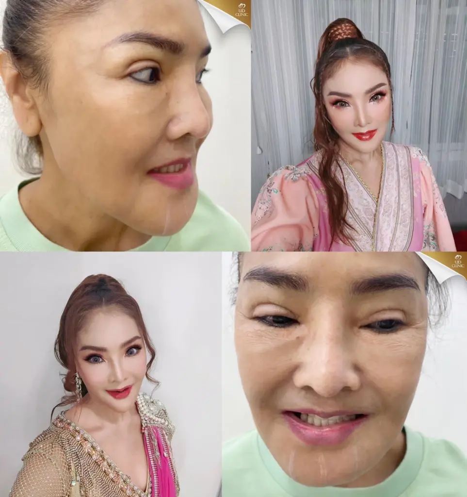 "ดาว มยุรี" สุดทนแล้วซัดกลับ! หลังโดนบูลลี่แรง ดึงหน้าจากผีเป็นตุ๊กตายาง