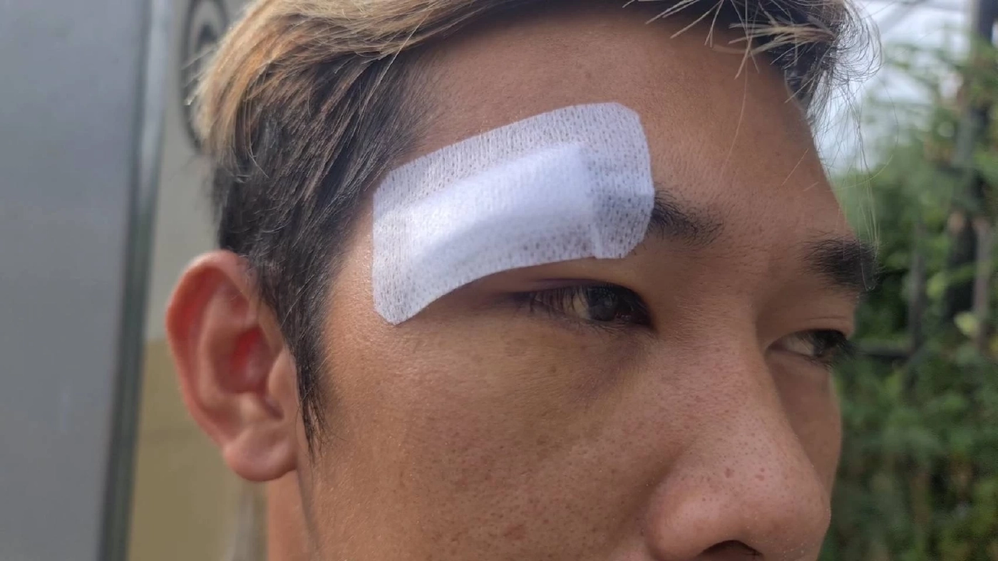 ตร.ว่าไง? "จ่าตำรวจ" จอมแสบ ลวงหนุ่มให้เจ้าของเว็บพนัน UFABET กระทืบเละ