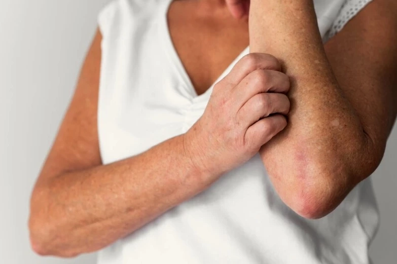 โลกร้อนขึ้นโอกาสเกิดมะเร็งผิวหนังเพิ่มขึ้น ไทยพบผู้ป่วยรายใหม่วันละ 12 คน