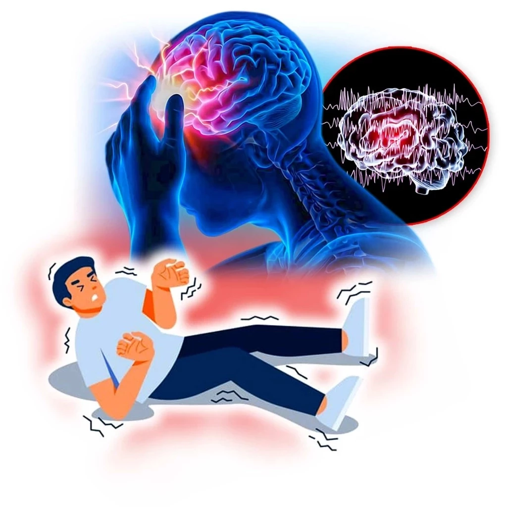 หนึ่งภัยเงียบอย่าชะล่าใจ "โรคลมชัก" พบเร็ว รักษาได้ โอกาสหายสูง