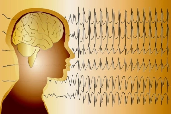 หนึ่งภัยเงียบอย่าชะล่าใจ "โรคลมชัก" พบเร็ว รักษาได้ โอกาสหายสูง