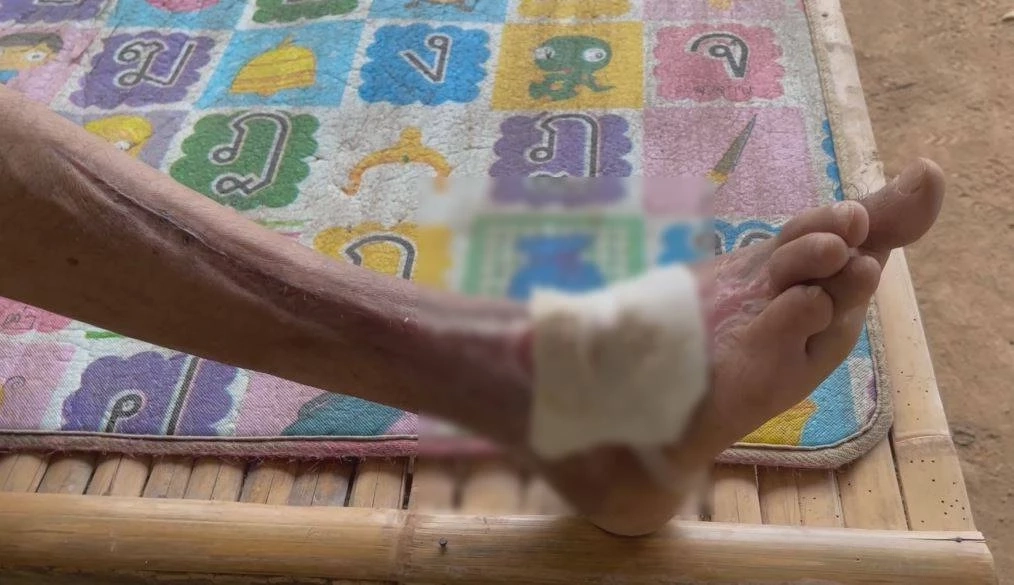 วอนช่วย เด็ก ม.1 เรียนดีแต่ยากจน อาศัยอยู่กับยาย-พ่อโดนงูฉกขาทำงานไม่ได้