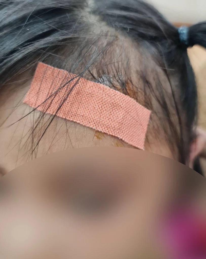 บุกช่วยเหลือเด็ก 5 ขวบถูกแม่แท้ ๆ ทำร้ายร่างกาย