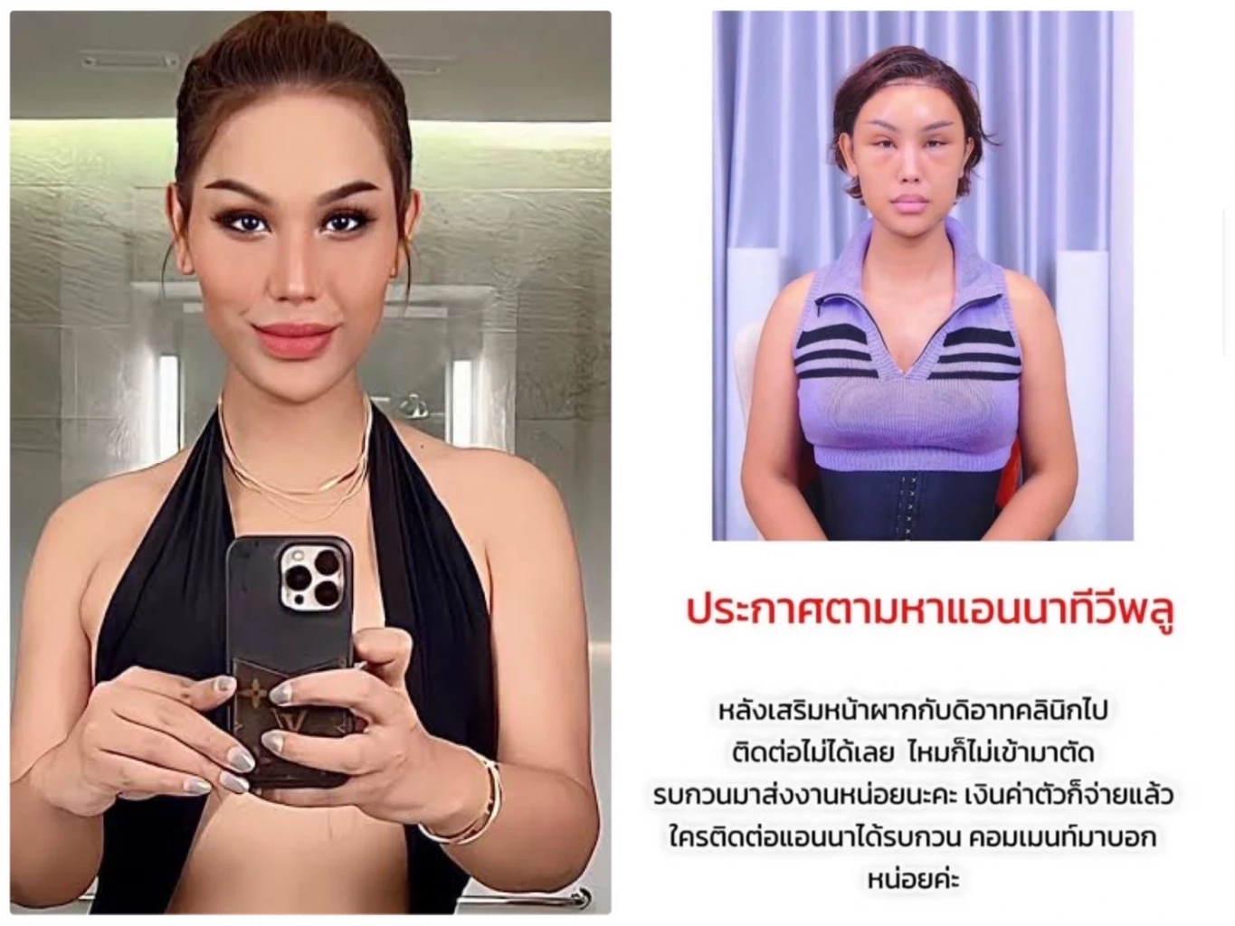 แอนนา! แจงปมหายหน้า ขอโทษรับงานซ้อน ด้าน พุดเดิ้ล ขายบ้านช่วยเพื่อน (มีคลิป)