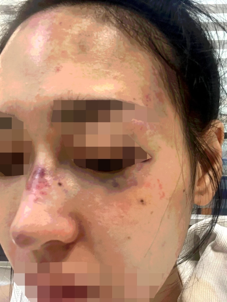 “กัน จอมพลัง”พาสาว 26 ปี เร่งคดีบุกทุบตีคาคอนโดฯ ปมหึงหวง