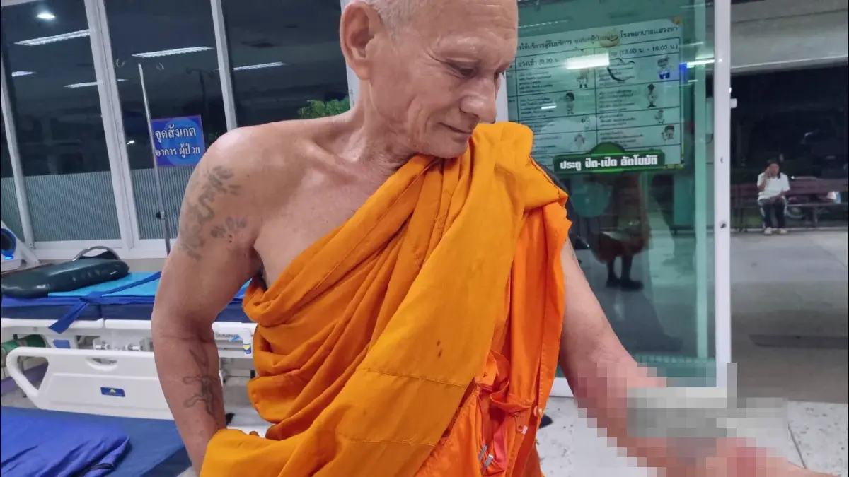 พระเล็ก ได้รับบาดเจ็บที่แขนซ้าย 