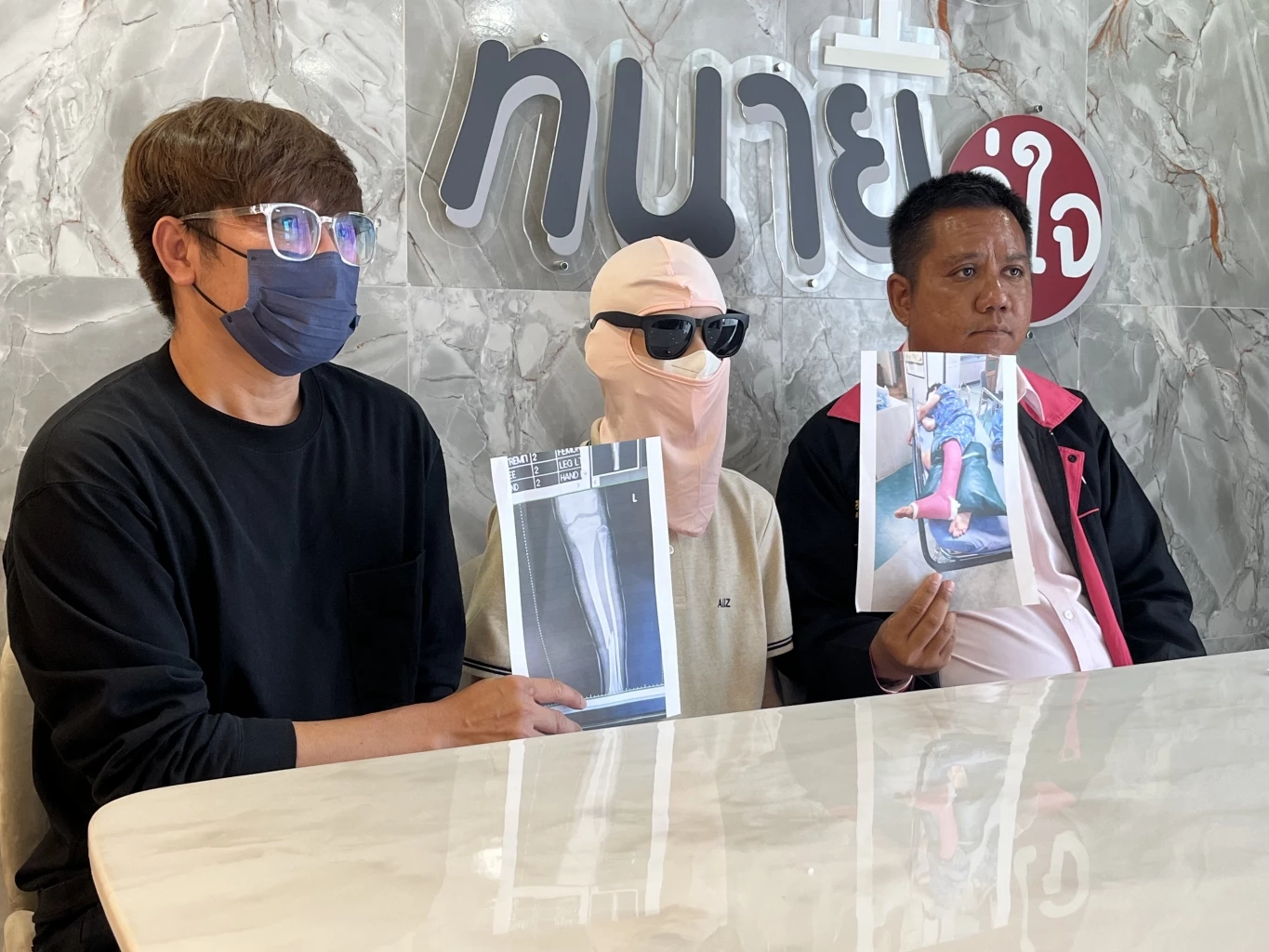 พ่อพา 11 ขวบ ขอ"ทนายรณณรงค์"ช่วย เพื่อนแกล้งจนขาหัก รักษาหมดเป็นแสน