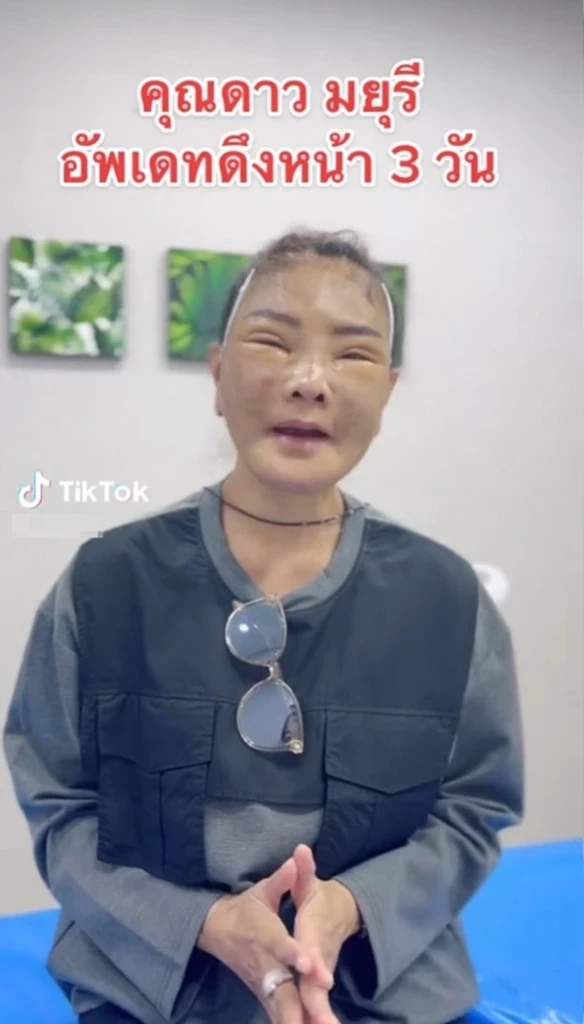 เปิดหน้าใหม่ “ดาว มยุรี” สวยจึ้งมาก โนแคร์โดนบลูลี่เหมือนตุ๊กตายาง