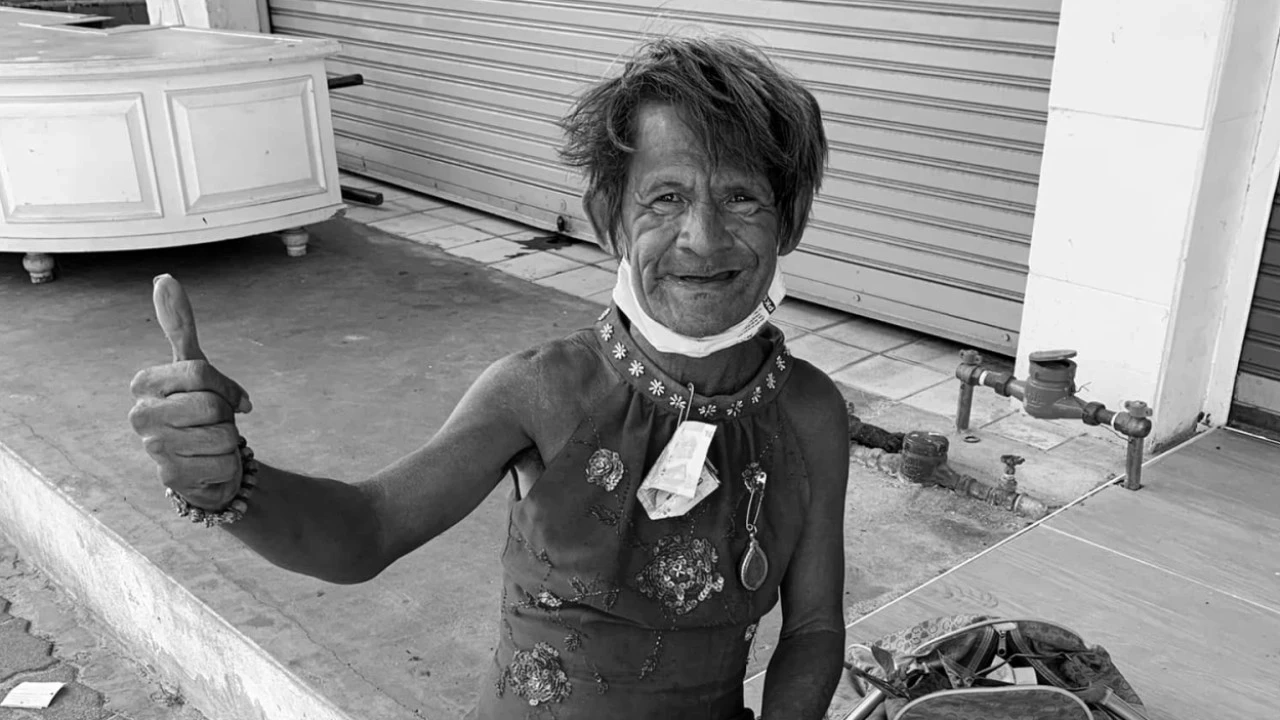 คืบหน้า คู่กรณีวัย 27 ปีขี่จยย.ชนป้าต้อย เมืองนนท์ อ้าง ถนนมืดมองไม่เห็น