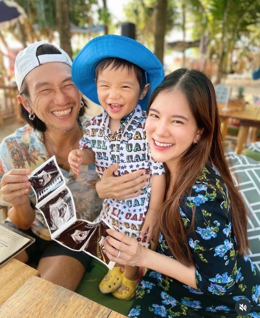 ซึ้งใจ "ก้อย รัชวิน" อุ้มท้องลูกคนที่สองดูแล "ตูน บอดี้สแลม" หลังผ่าตัดใหญ่