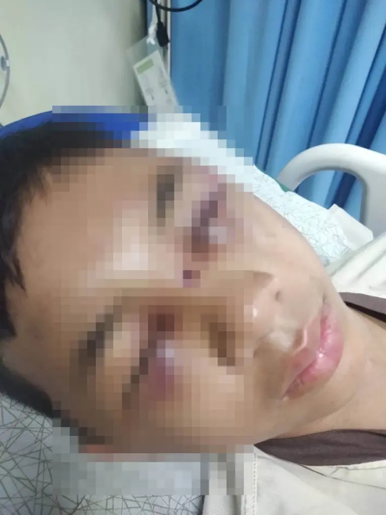 แจ้งจับพ่อเลี้ยงโหด ระดมทั้งหมัดทั้งแข้ง ทำร้ายลูกเลี้ยงสาหัส