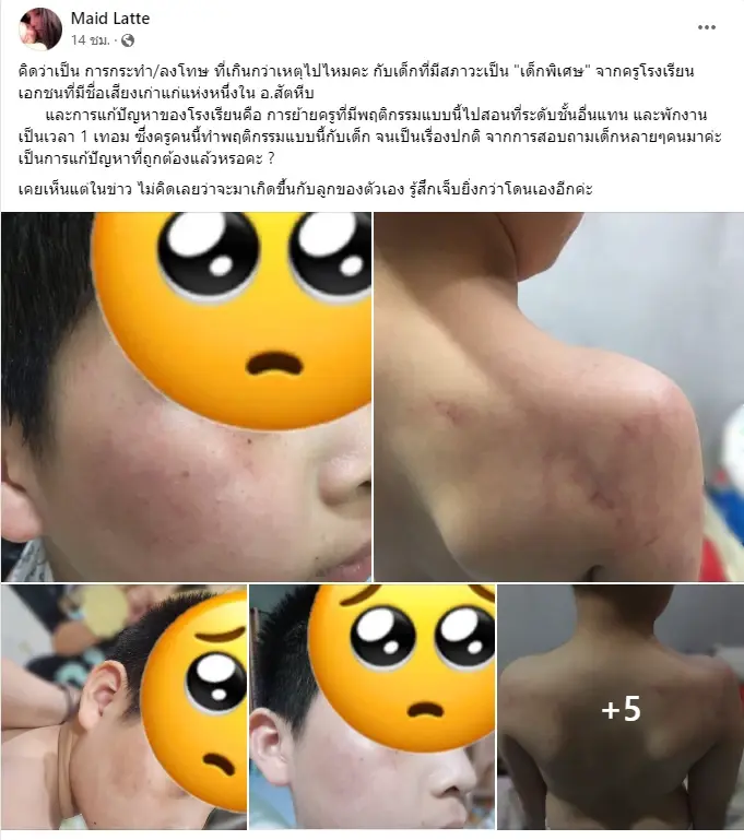 แม่สุดทน โพสต์แฉพฤติกรรมครู รร.ดังสัตหีบ ลงโทษลูกเด็กพิเศษบอบช้ำ