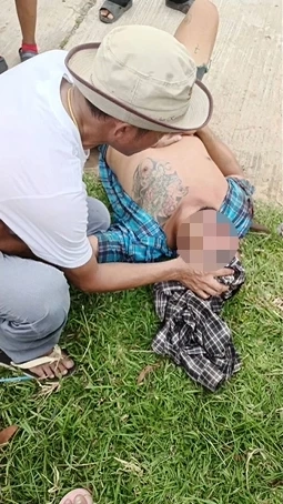 ผู้บาดเจ็บในเหตุการณ์