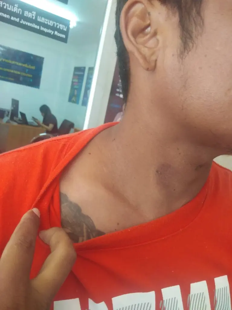 นายเอนก คงทวี อายุ 34 ปี ผู้ต้องหาที่ถูกคลุมถุงดำ ซ้อมยัดคดี