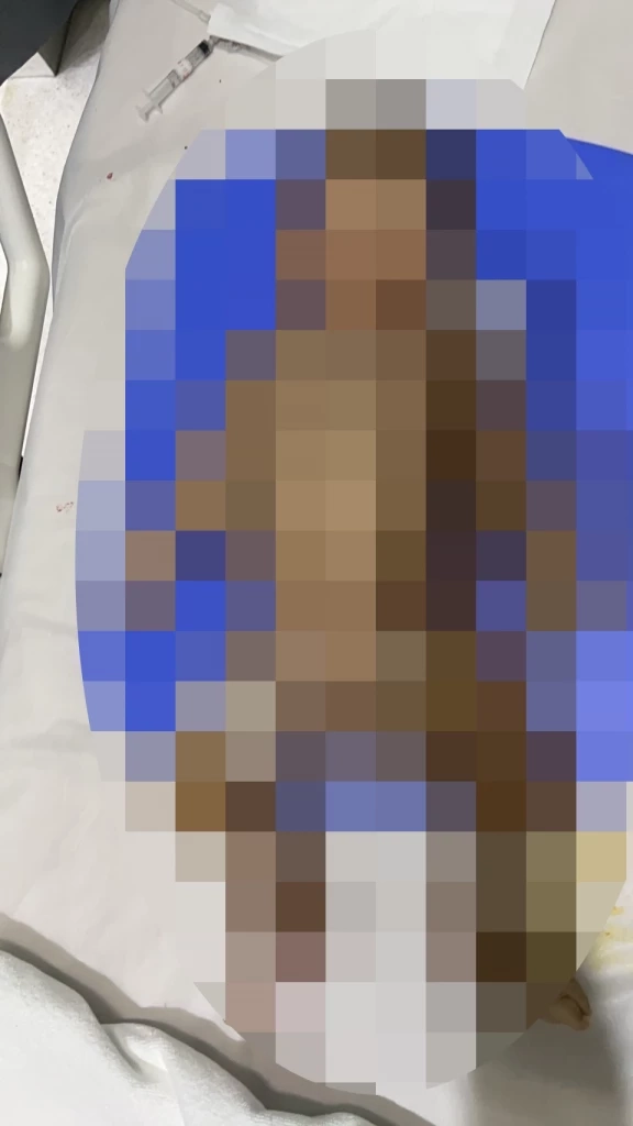 แม่ร้องทนายดัง ครูเนอสเซอรี่ทำลูกวัย 3 เดือนดับ หลังไปฝากเลี้ยงแค่วันเดียว