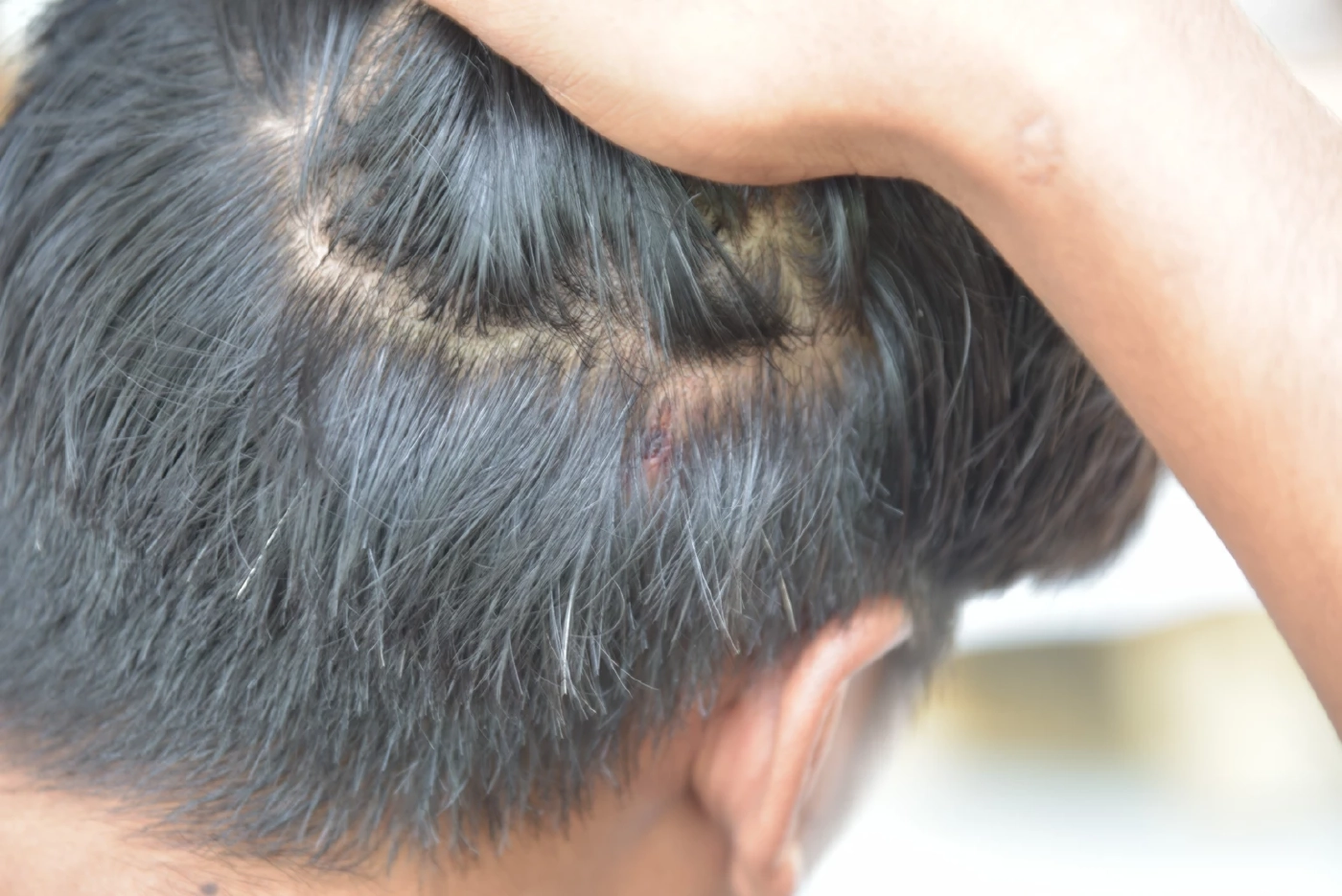 นายเดชา จุนผักแว่น ผู้ที่ถูกทำร้าย 