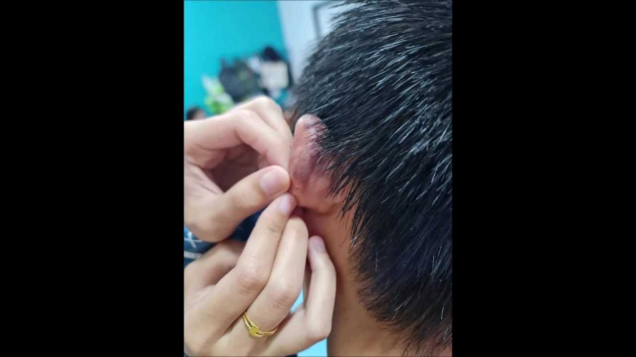 ผอ.แจง แม่ไลฟ์สดลูกถูกทำร้าย เป็นเหตุเด็กตีกัน คิดว่าเคลียร์กันจบไปแล้ว