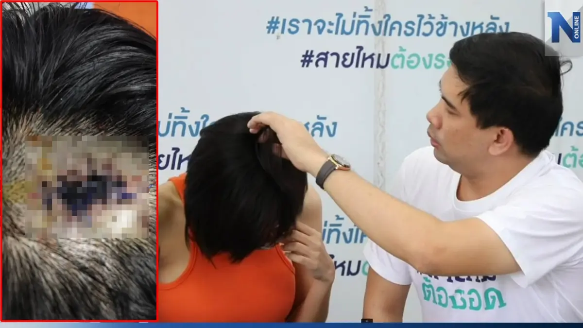 พริตตี้สาว ร้องเพจสายไหมฯ อดีตแฟนหนุ่ม ทุบตี ลิดรอนอิสระ