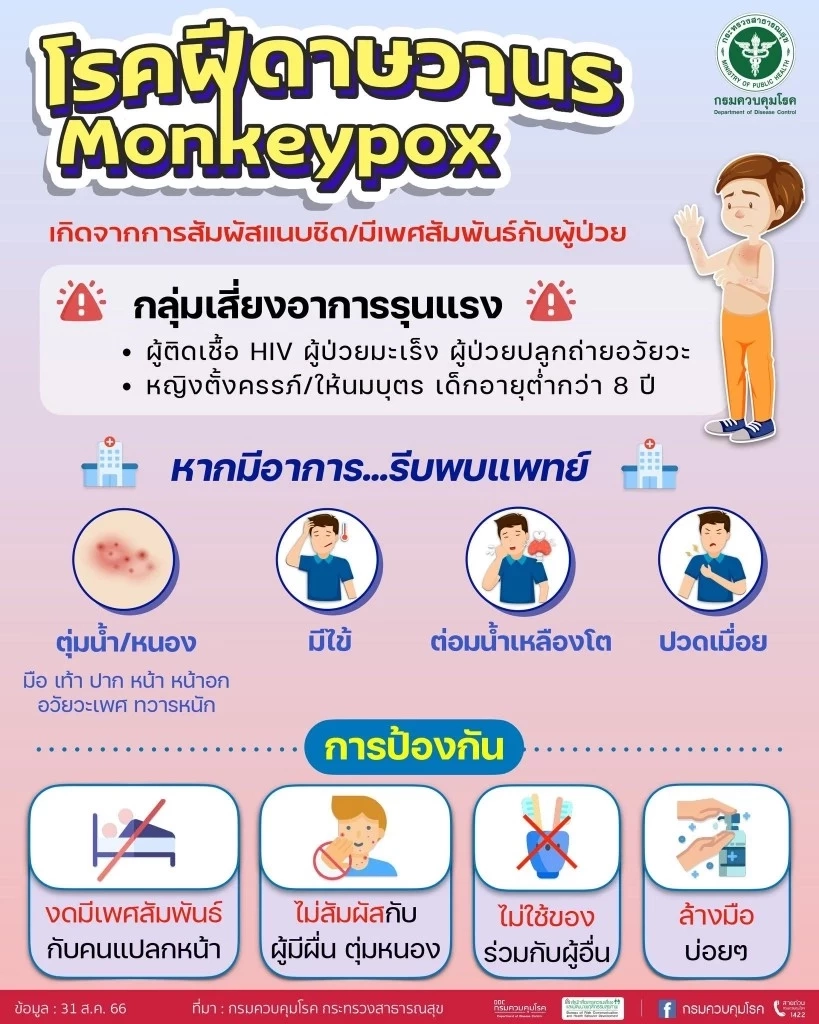 อัปเดตโรคฝีดาษลิง เสียชีวิตเพิ่ม 1 ราย ล่าสุดยอดติดเชื้อในไทยพุ่ง 385 ราย 