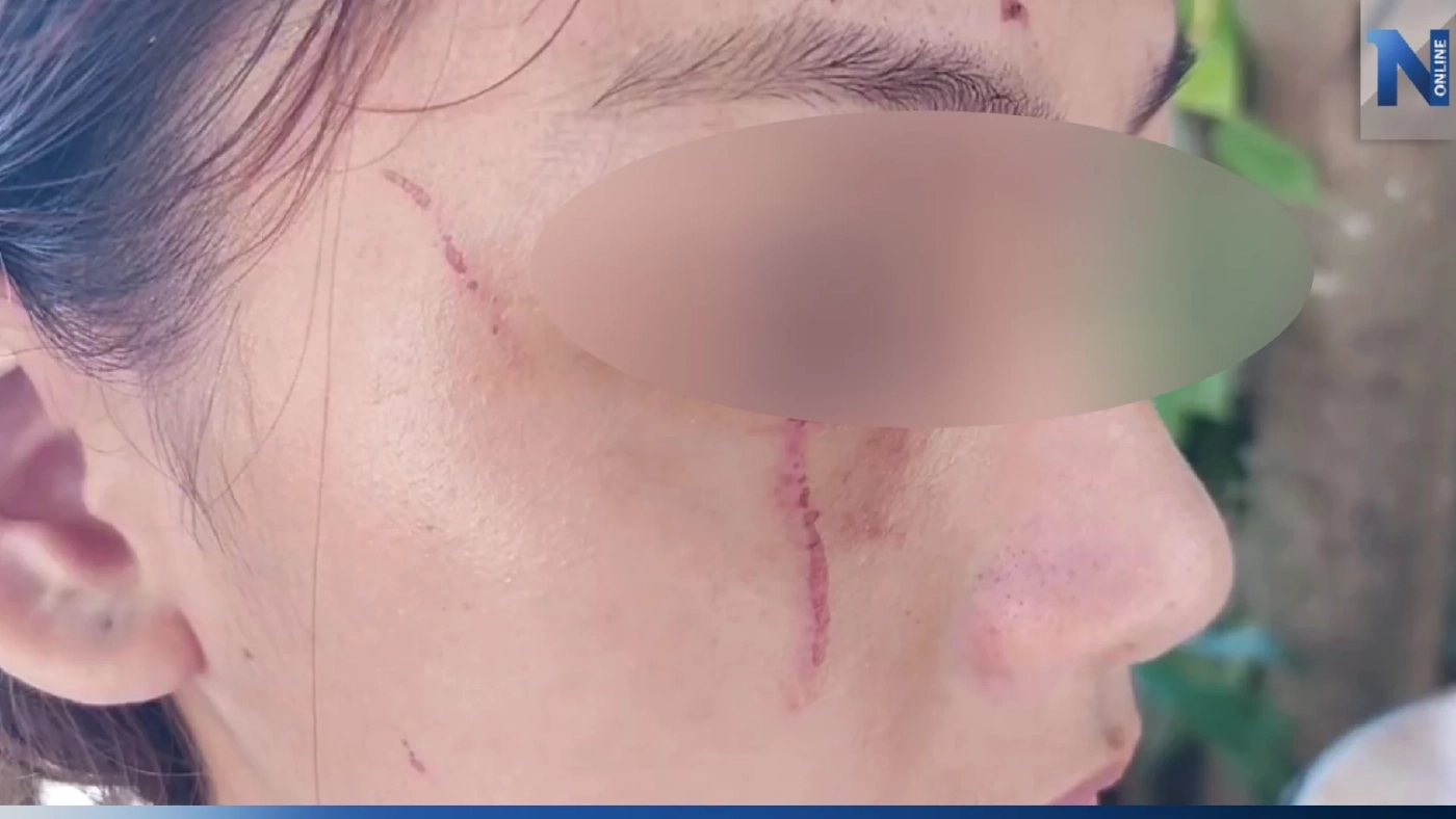 แม่นักเรียน ม.5 ร้องสื่อ เด็กทะเลาะกันเคลียร์แล้ว แต่ผู้ใหญ่ไม่จบ