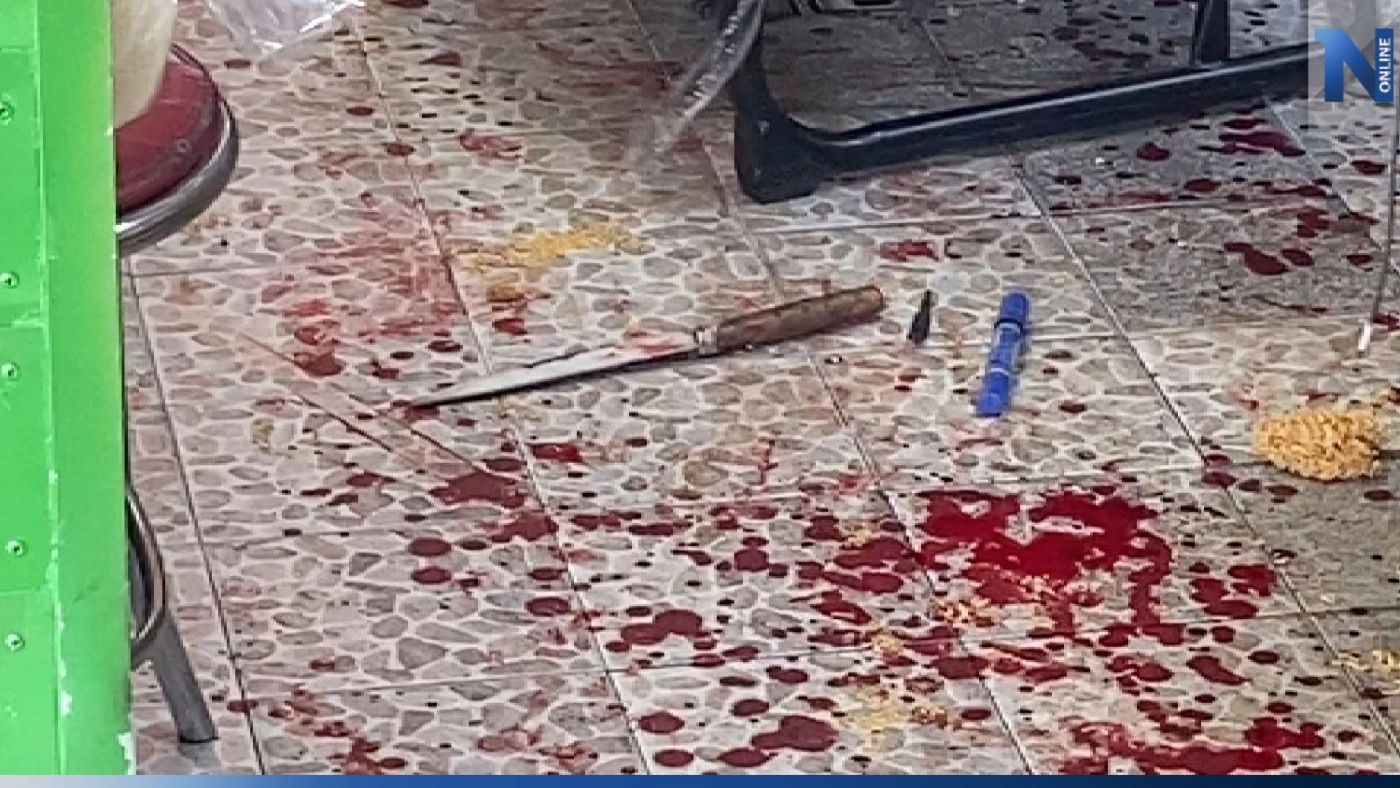 สองคนร้ายโหดใช้มีดหวดดายหญ้าฟันเจ้าของร้านชิงทอง10บาท