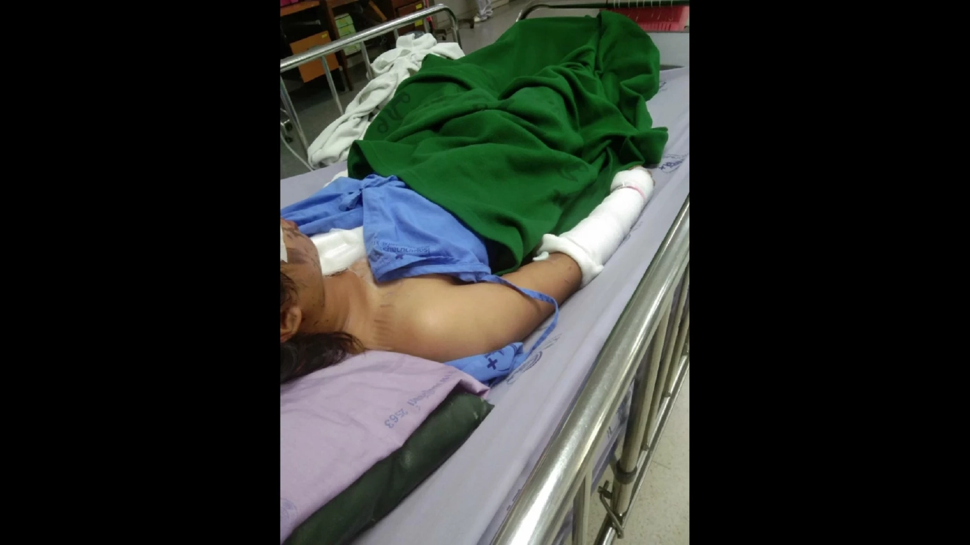 อาการน้องอั้ม ยังน่าห่วง