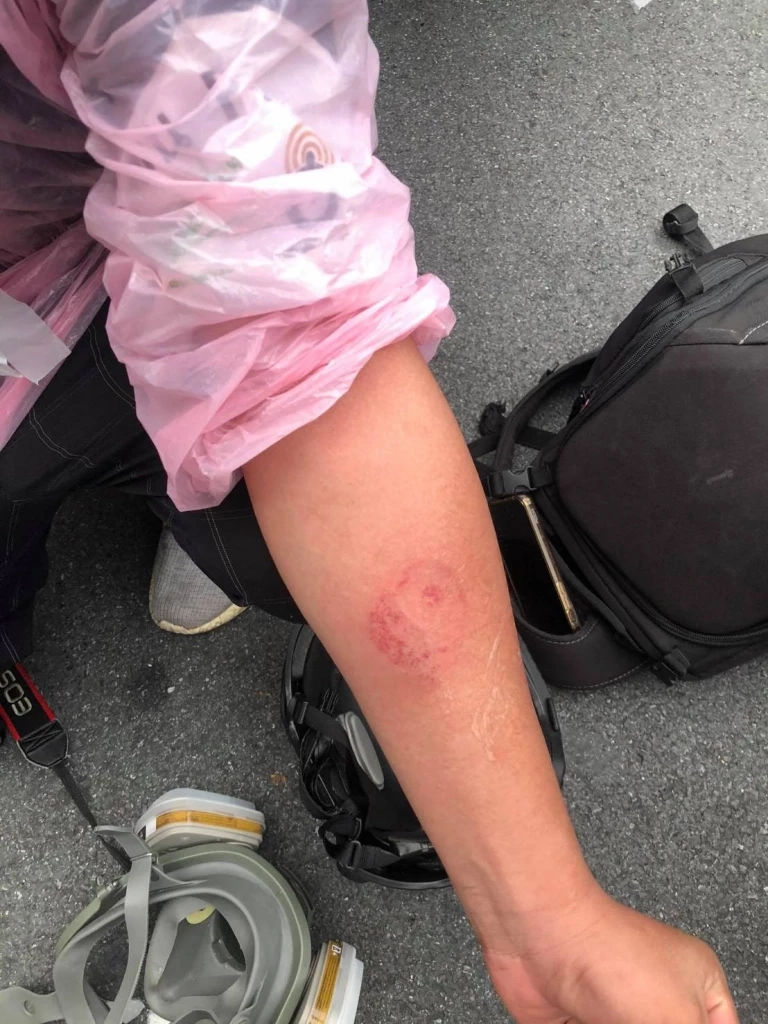 ร่องรอยกระสุนยาง ที่ยิงใส่สื่อมวลชน