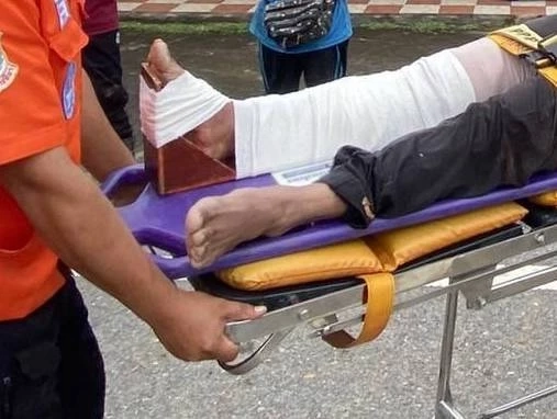 "กระทิงโทน" ป่าทับลาน ออกหากินนอกแนว ขวิดชาวบ้าน เจ็บ 2 ราย